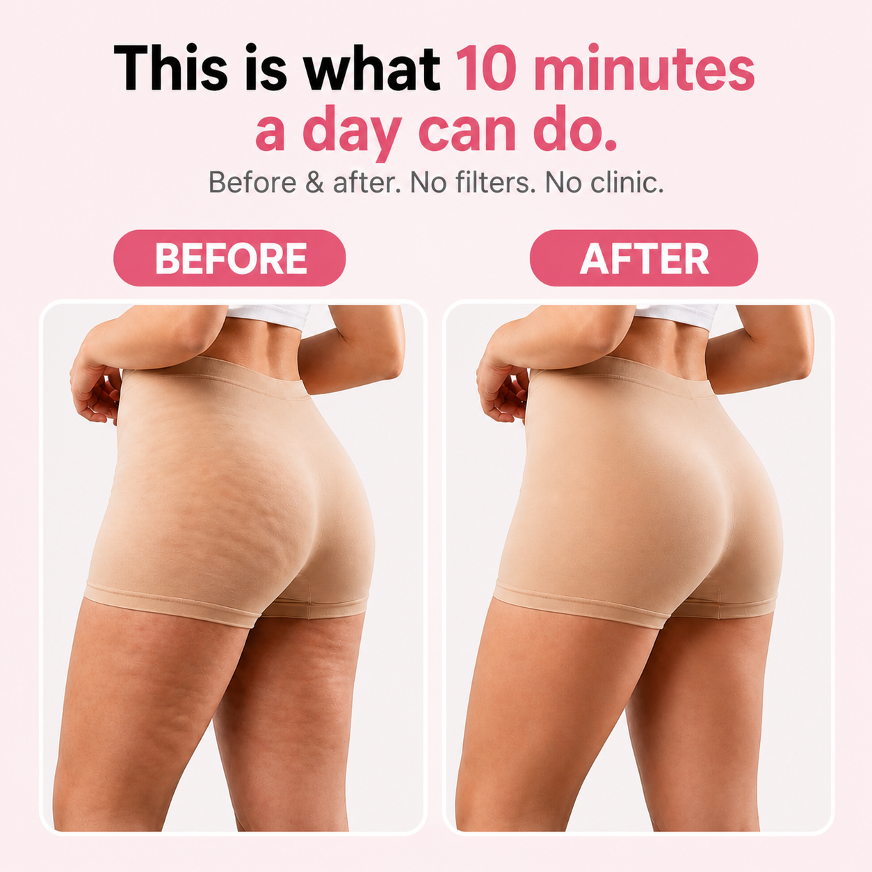 Coselle™ Anti-Cellulite Massager